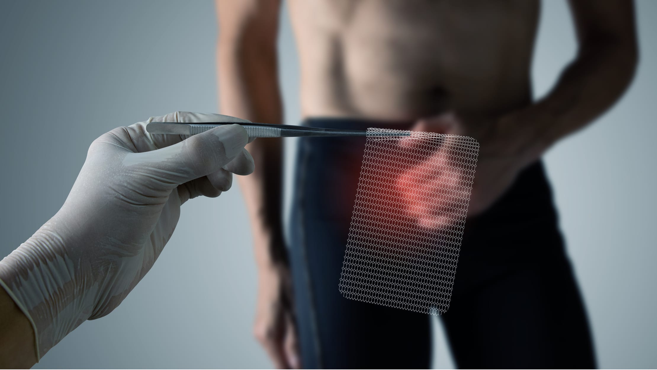 Doc on Duty: When Should I Get a Hernia Fixed?
