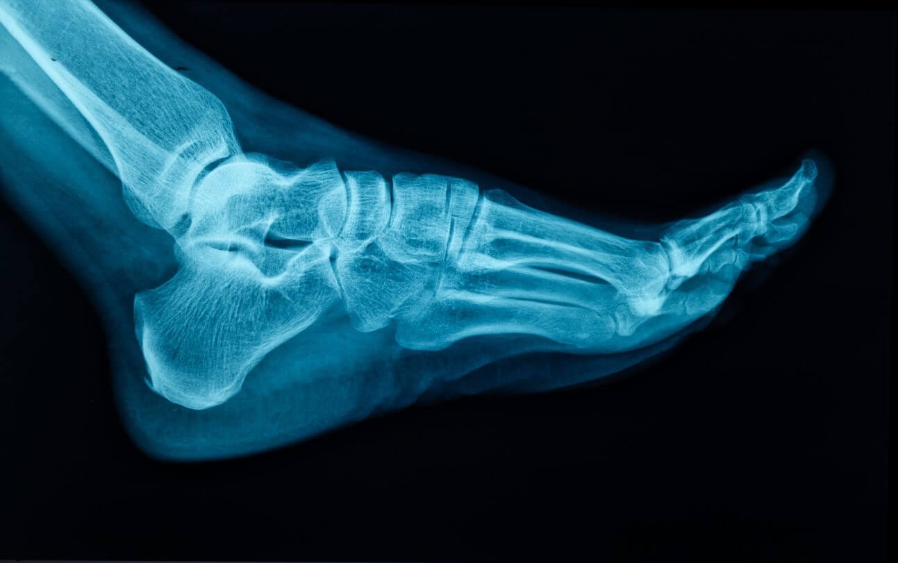 Wellness Wednesday – Foot Health